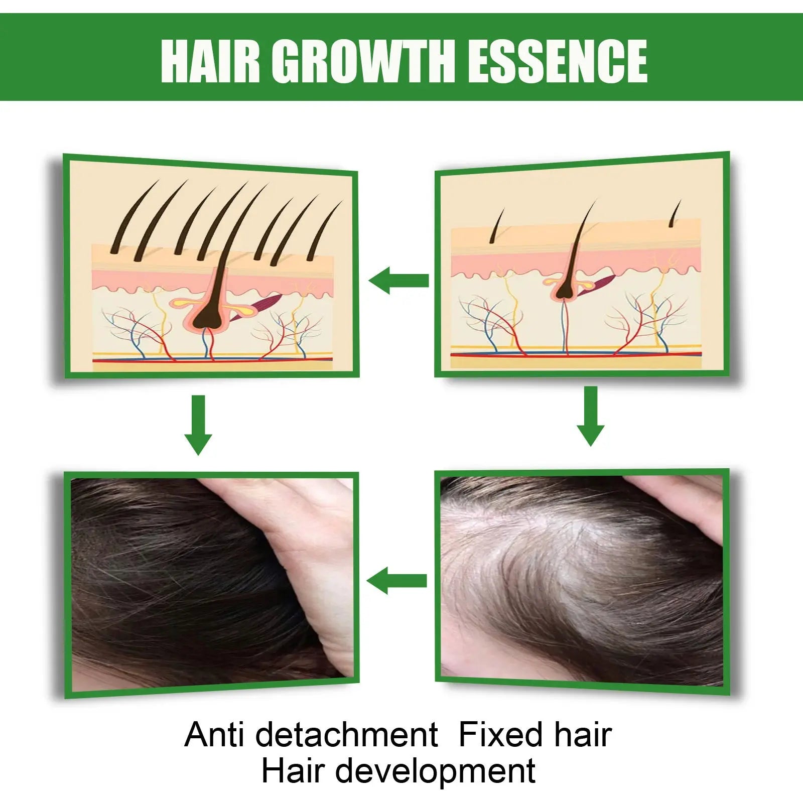 Ginger Hair Growth Moisturizing Nutrition Spray Fitness Task